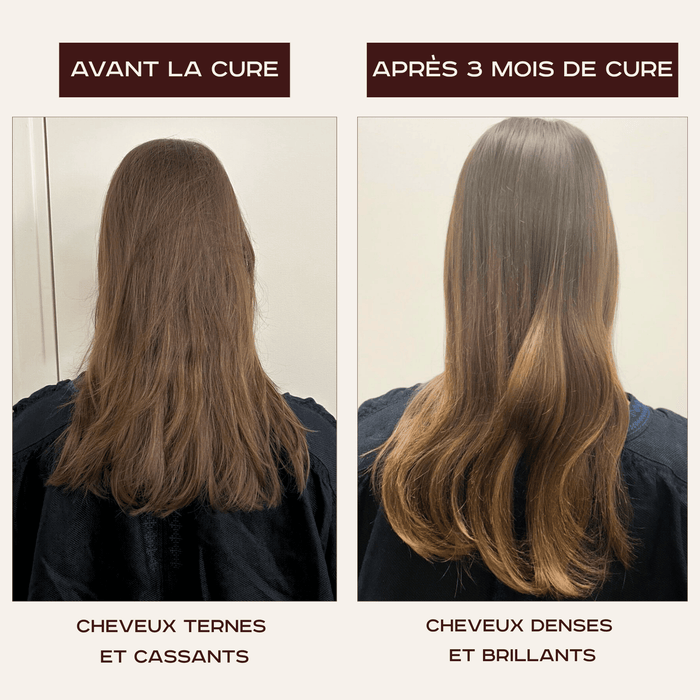 Cure La Chevelure