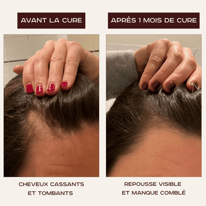 Cure La Chevelure