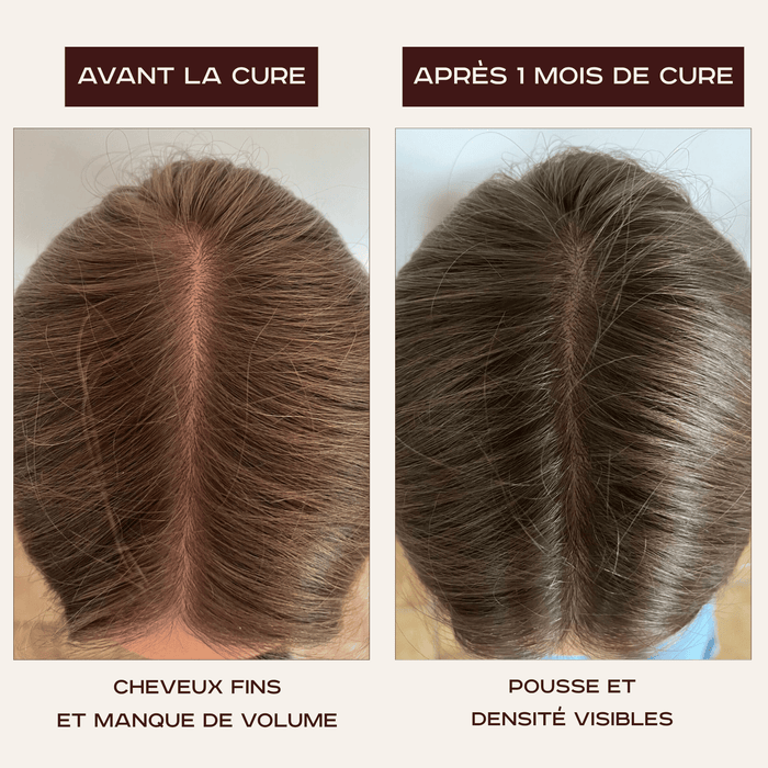 Cure La Chevelure