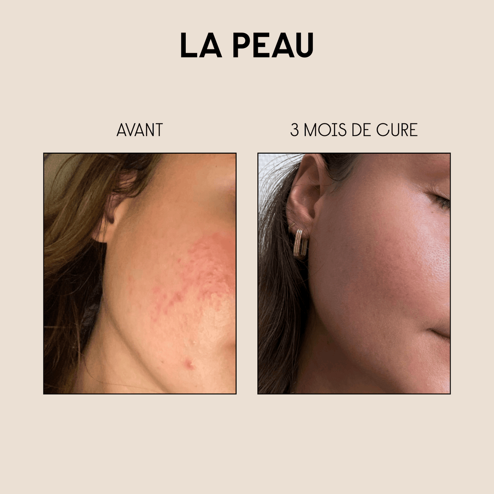 Pack Peau & Cheveux