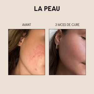 Pack Peau & Cheveux
