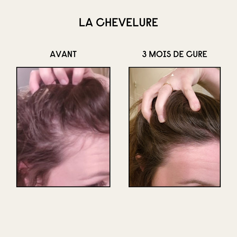 Cure Peau & Cheveux